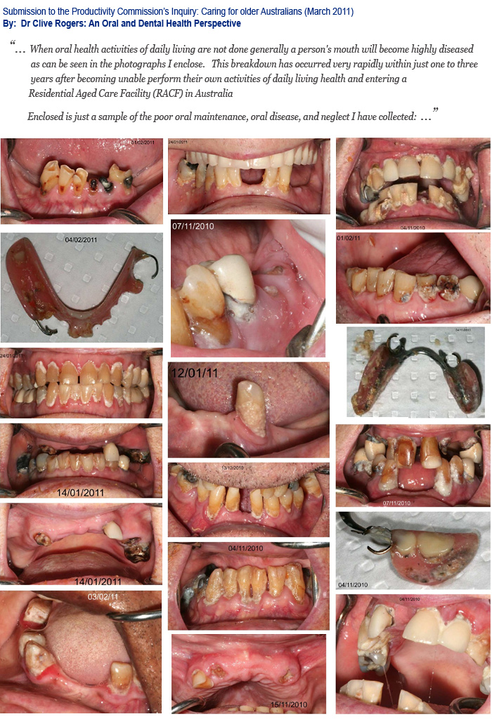 Dr Clive Rogers (Dentist) submission to the Caring for Older Australians Inquiry