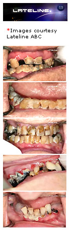 Dentist appalled at nursing home dental care